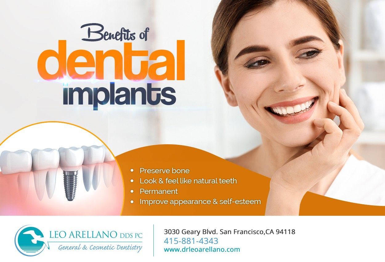 Dental implant insurance